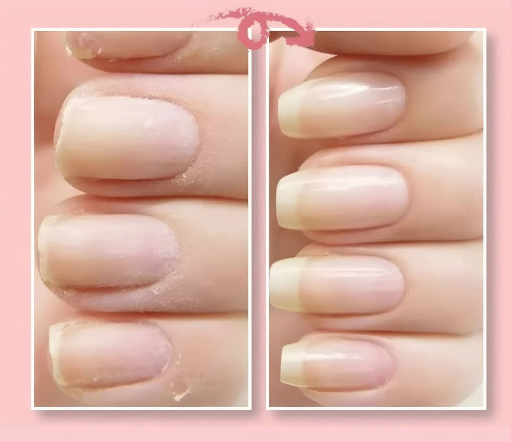 NailRevive™ | Reparaturgel für rissige Nägel (1+1 GRATIS)